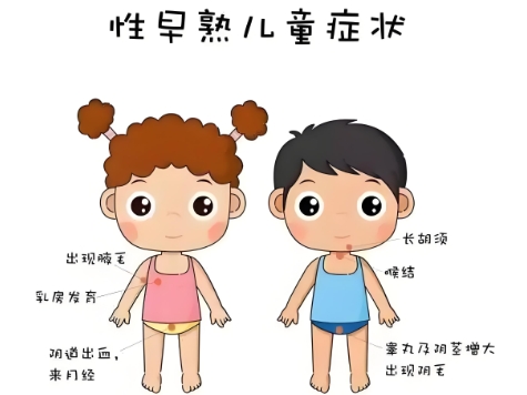 广州儿童性早熟